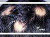 حمله سیستم ایمنی به فولیکول‌های مو
