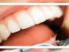 جرم‌گیری دندان؛ راهی برای پیشگیری از بیماری‌های لثه‌ای و حفظ سلامت دهان