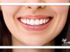 ورزش و امگا۳، ترکیب طلایی برای پیشگیری از التهاب ریشه دندان