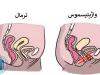 روش های بهبود قطعی واژینیسموس یا عدم دخول