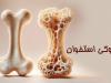 چطور با «پوکی استخوان» مقابله کنیم؟