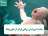سلامت نوزادان ایرانی فراتر از خاورمیانه