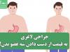 جراحی لاغری به قیمت از دست دادن سه عضو بدن!