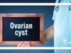 کیست تخمدان؛ شایع اما غالباً بی‌خطر در زنان بارور