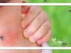 بهترین راهکار برای دفع پشه