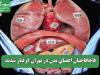 قاچاقاچیان اعضای بدن در تهران گرفتار شدند