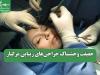 حقیقت وحشتناک جراحی‌های زیبایی مرگبار