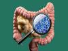 میکروبیوم قوی روده می تواند در مبارزه با عفونت موثر باشد