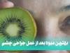 مصرف میوه و آب میوه بعد از عمل جراحی چشم + جدول