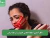 ناکارآمدی لایحه کاهش خشونت بر علیه زنان