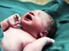 نوزاد ۷۷۰ گرمی در بیمارستان علوی اردبیل متولد شد