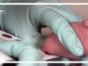 این علائم از ابتلای کودک به فنیل کتونوری خبر می‌دهد