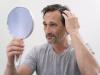 کاشت مو برای آقایان و بانوان؛ چه افرادی کاندید مناسب هستند؟