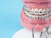 چگونه ارتودنسی به بهبود عملکرد جویدن و سلامت لثه کمک می‌کند؟