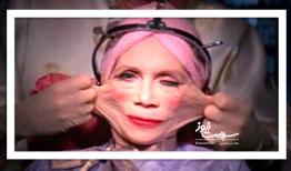 چالش‌های تبلیغات جراحی زیبایی در فضای مجازی: افزایش نظارت و آگاهی‌سازی ضروری است