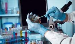 سازمان انتقال خون محور توسعه بانک سلول‌های بنیادی