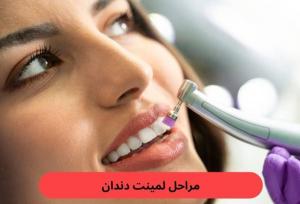 چگونه سایه مناسب لمینت دندان، چهره شما را جوان‌تر نشان می‌دهد؟