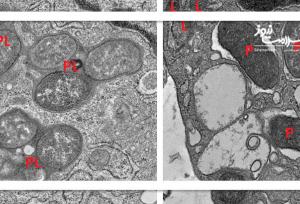 هوش مصنوعی راز تعادل سیستم ایمنی روده را فاش کرد: همکاری GIV و NOD2
