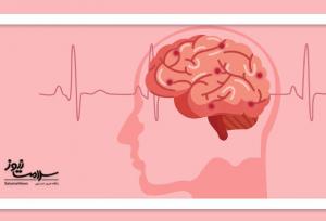 خبر خوش برای بیماران سکته مغزی؛ داروی ترامولیز شانس بهبودی را دو برابر می‌کند