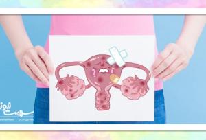 نفخ مداوم می‌تواند نشانه‌ای از سرطان تخمدان باشد