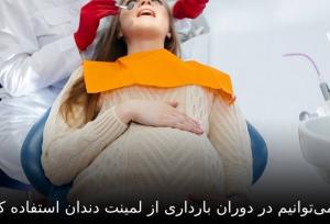 آیا می‌توانیم در دوران بارداری از لمینت دندان استفاده کنیم؟