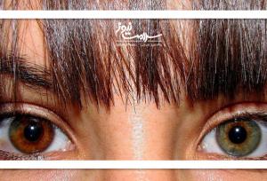 جراحی زیبایی خطرناکی که پشیمانی به بار می‌آورد