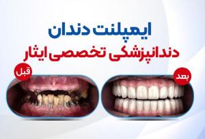 نتانیاهو گوش به زنگ دستورات ترامپ علیه ایران