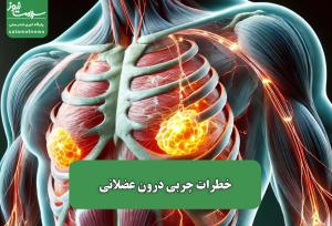 خطرات چربی درون عضلانی