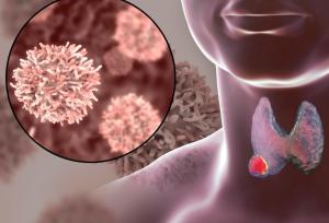 باکتری‌ دهان که سلول‌های سرطانی را نابود می‌کند