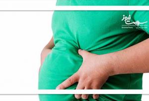 کدام افراد چاق نیاز به جراحی لاغری دارند؟