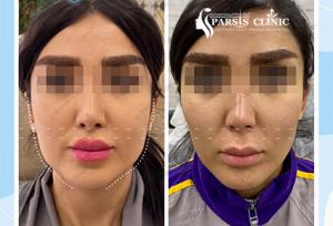 بهترین کلینیک لیفت و جوانسازی صورت در کرج + لیست ۱۰ کلینیک برتر
