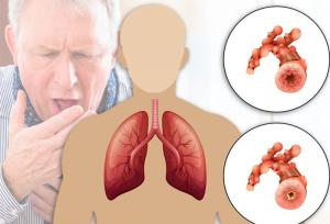 ابتلای 10 میلیون ایرانی به آسم و انسداد ریوی/ غلظت آلاینده‌های هوای تهران 30 برابر حد مجاز