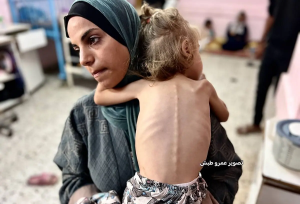 وضعیت وخیم «سندریلا غزه»