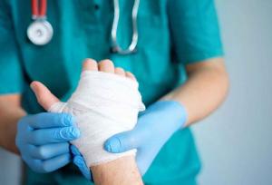 ۱۰۲ بیمار سوختگی در سیستان تحت درمان قرار گرفتند