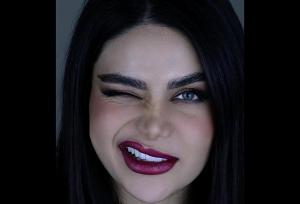 قیمت کامپوزیت دندان در سال ۱۴۰۴ (پرداخت اقساطی هزینه)