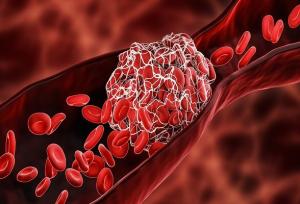 چربی خون بالا؛ دشمن خاموش رگ‌ها