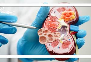 گرمای شدید و سرمای افراطی، دشمن پنهان کلیه‌ها