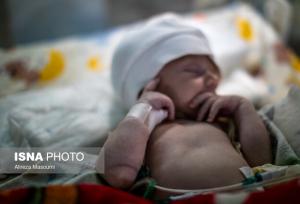 ناهنجاری‌های بدو تولد اولین عامل مرگ کودکان زیر 5 سال