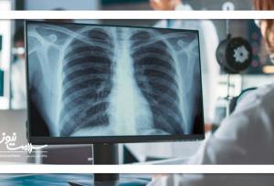 هوش مصنوعی از روی عکس رادیولوژی پوکی استخوان را تشخیص میدهد