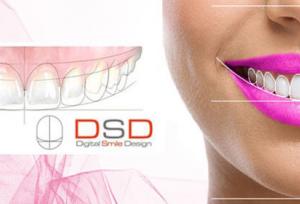 لمینت دندان چیست و لمینت برای چه دندان هایی مناسب است؟