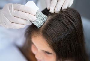 شپش سراغ چه کسانی می‌رود؟