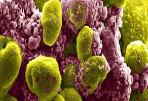 تاثیر یک ترکیب دارویی در کاهش خطر مرگ ناشی از سرطان