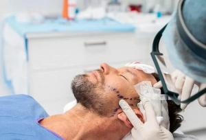 کاشت ریش دائمی هست یا موقت؟