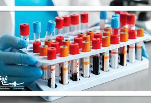 چه زمانی آزمایش خون ضروری است؟