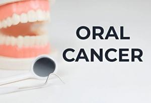 سرطان دهان چیست؟