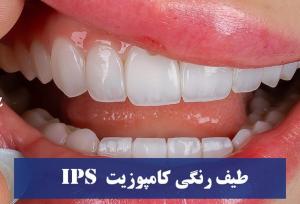 طیف رنگی کامپوزیت IPS : رنگ BLXL و رنگ bll
