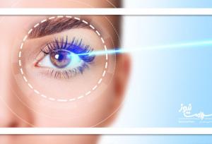 لیزیک را فراموش کنید: روش اصلاح بینایی ایمن‌تر و ارزان‌تر به زودی عرضه می‌شود