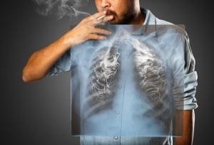 فناوری هسته‌ای، سلاحی نو در تشخیص کشنده‌ترین سرطان جهان