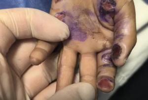 فوت دردناک یک کودک ۴ساله در پی آزار و اذیت