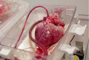 انتقال قلب برای پیوند به نوجوان ۱۵ ساله با اورژانس هوایی